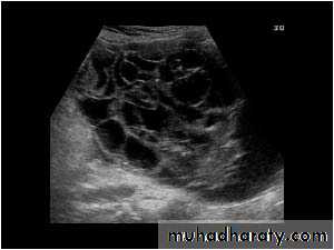 Ultrasonography in Gynaecology