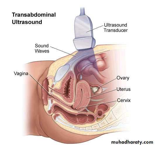 Ultrasonography in Gynaecology