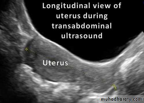 Ultrasonography in Gynaecology