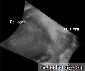 Ultrasonography in Gynaecology
