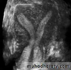 Ultrasonography in Gynaecology