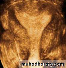 Ultrasonography in Gynaecology