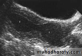 Ultrasonography in Gynaecology