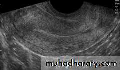 Ultrasonography in Gynaecology