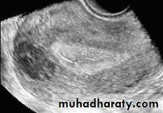 Ultrasonography in Gynaecology