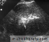 Ultrasonography in Gynaecology
