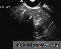 Ultrasonography in Gynaecology