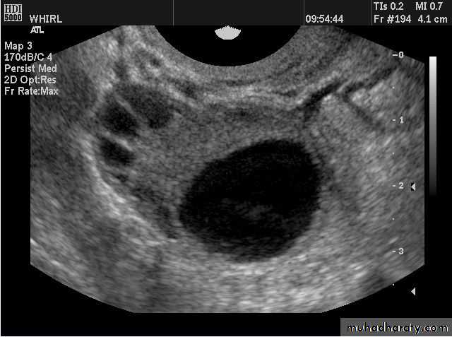 Ultrasonography in Gynaecology