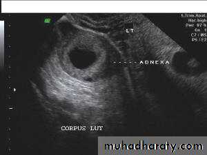 Ultrasonography in Gynaecology