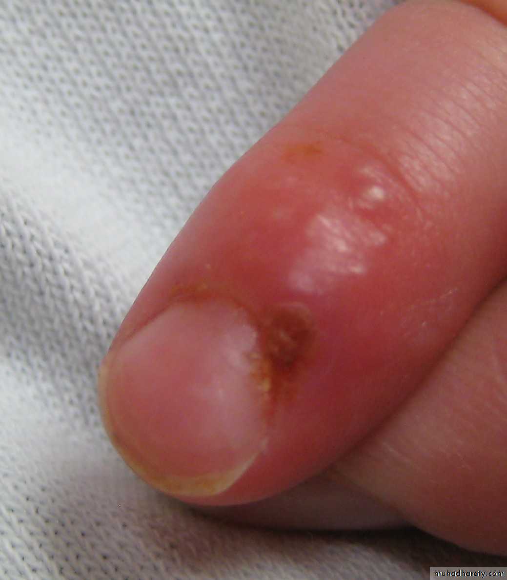 Infectious Diseases