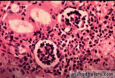 Infectious Diseases