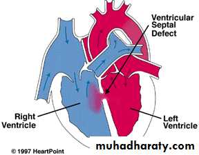 Cardiovascular System