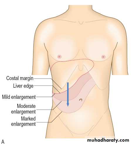 Macleods Clinical Examination 13th edition