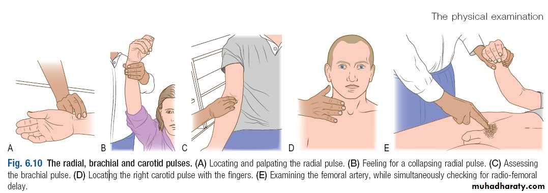 Macleods Clinical Examination 13th edition