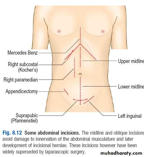 Macleods Clinical Examination 13th edition
