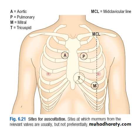 Macleods Clinical Examination 13th edition