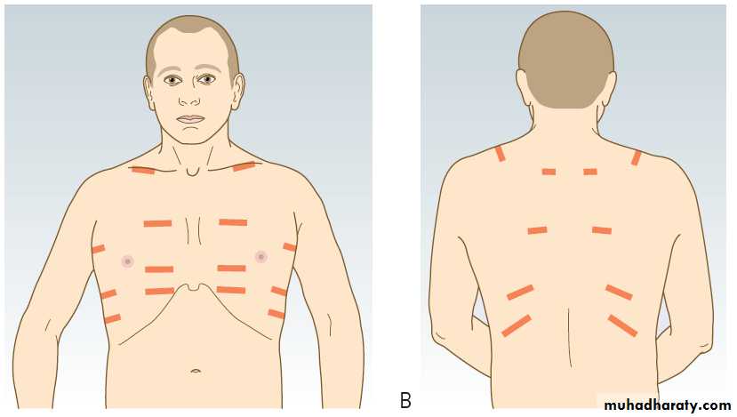 Macleods Clinical Examination 13th edition