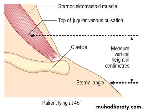 Macleods Clinical Examination 13th edition