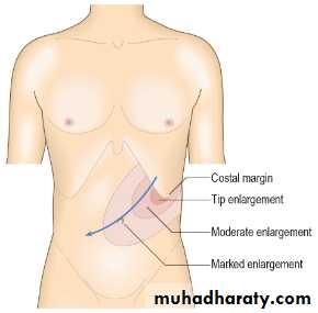 Macleods Clinical Examination 13th edition