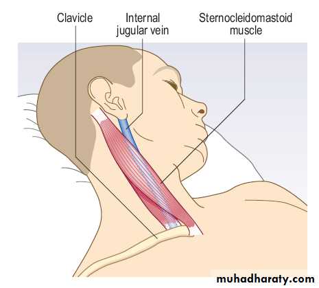 Macleods Clinical Examination 13th edition