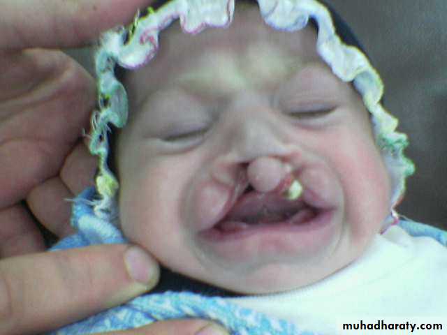 Pediatric surgery