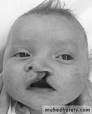 Pediatric surgery