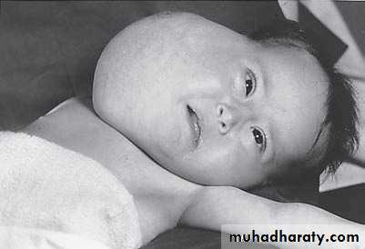 Pediatric surgery