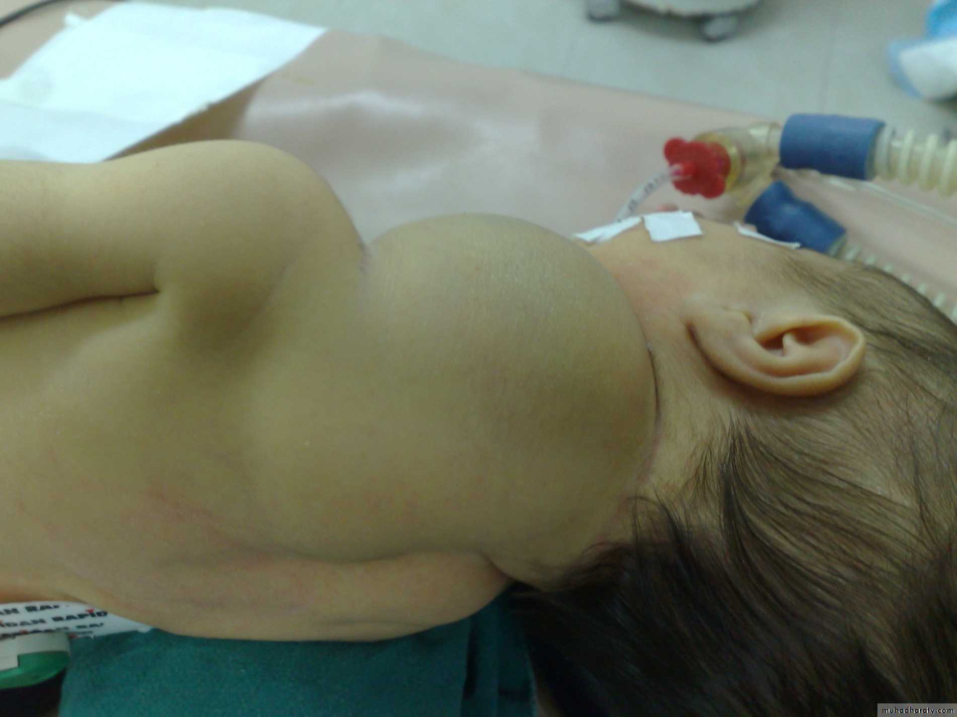 Pediatric surgery