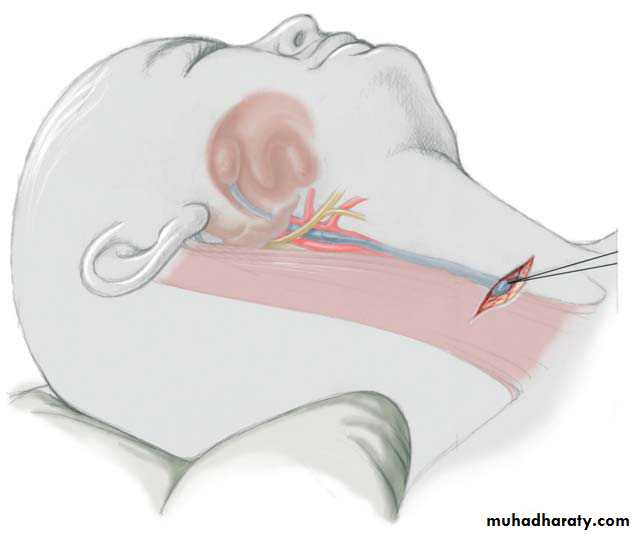 Pediatric surgery