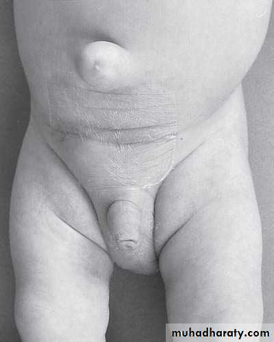 Pediatric surgery