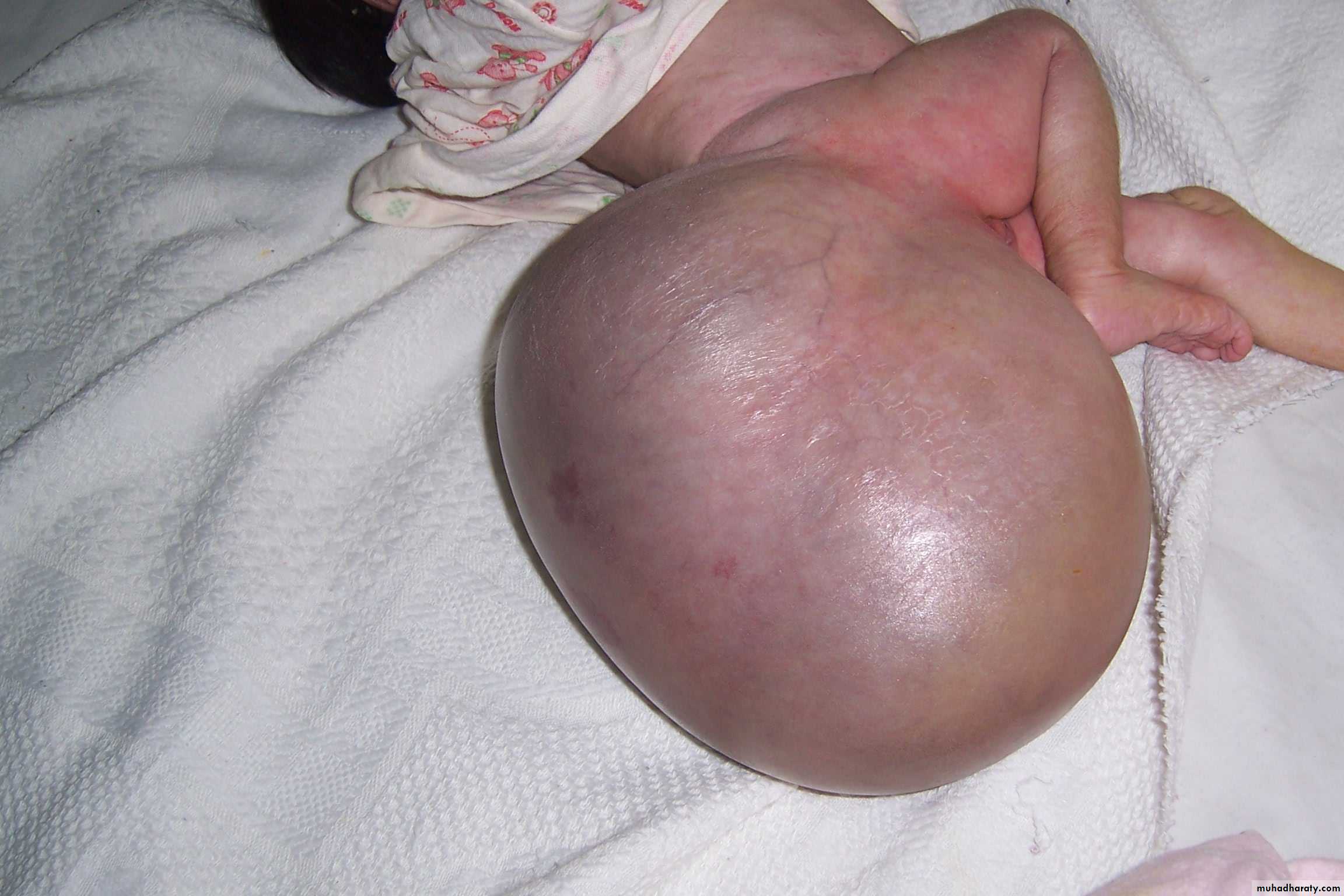 Pediatric surgery