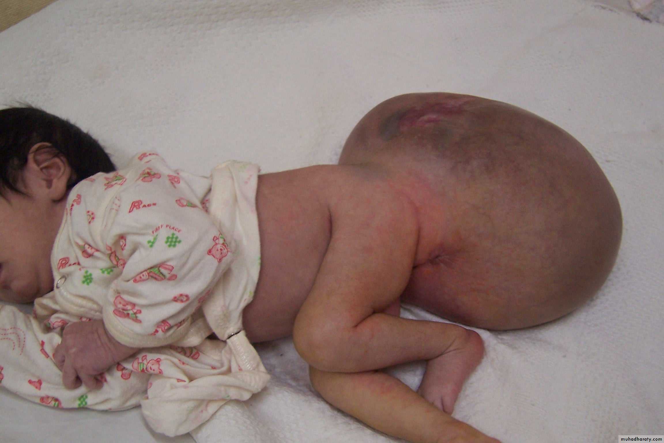 Pediatric surgery