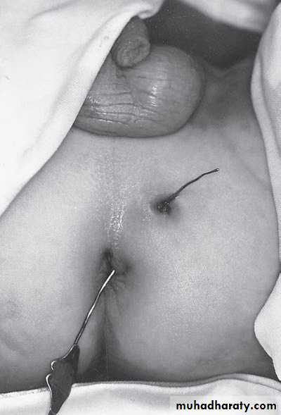 Pediatric surgery