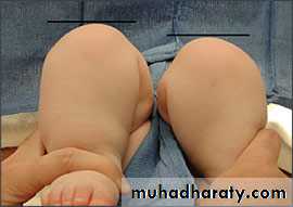 Orthopedic surgery