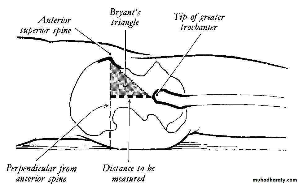 Orthopedic surgery
