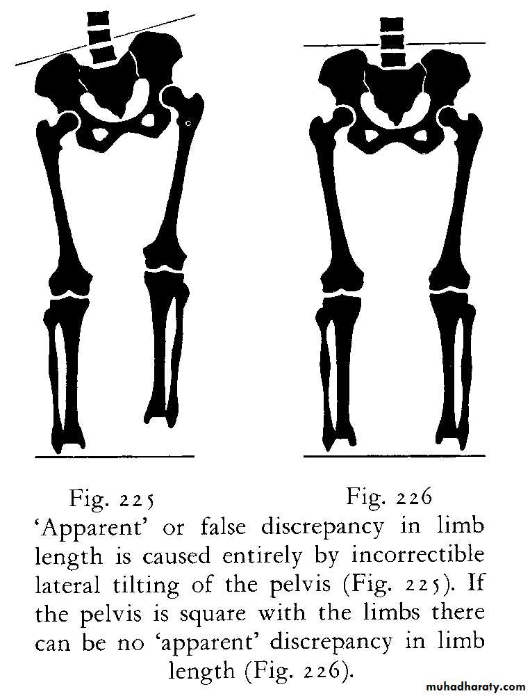 Orthopedic surgery