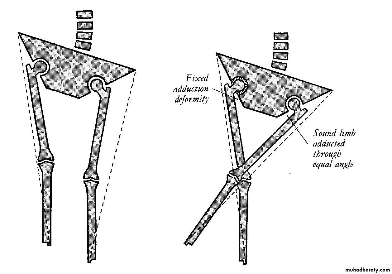 Orthopedic surgery