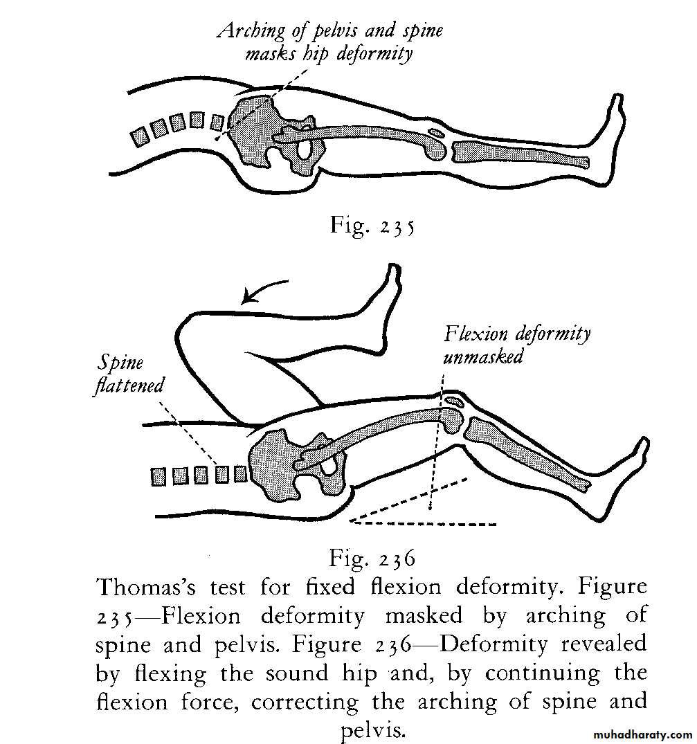 Orthopedic surgery