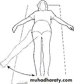 Orthopedic surgery