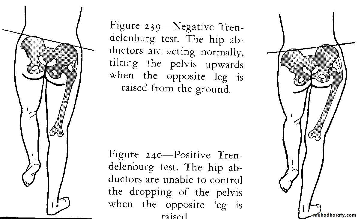 Orthopedic surgery