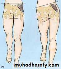 Orthopedic surgery