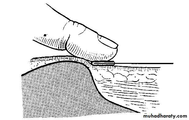 Orthopedic surgery