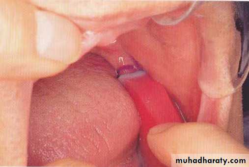 صناعة