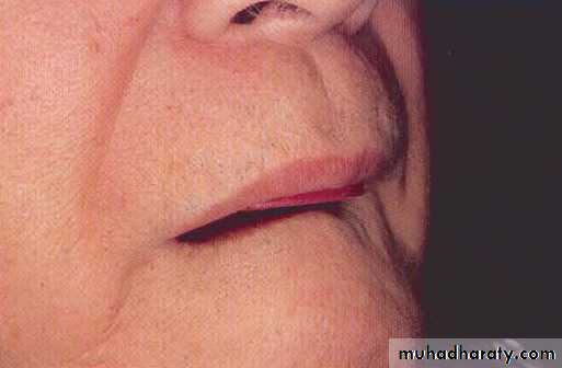 صناعة