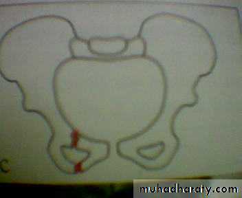 pelvis