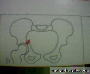 pelvis