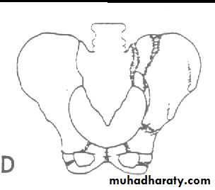 pelvis