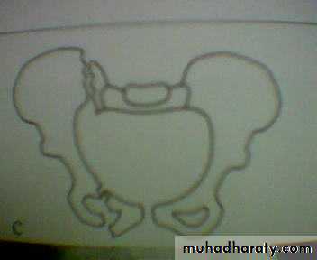 pelvis