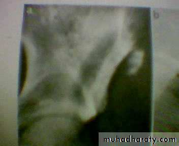 pelvis