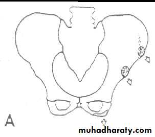 pelvis
